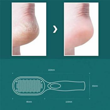 Wholesale Foot Board Frustration Tool Callus Dead Skin Remover stainless steel pedicure foot file